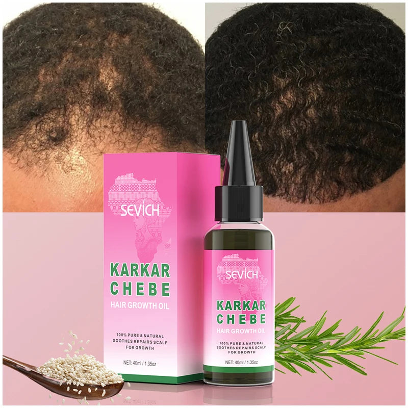 Sevich Natural Karkar Chebe Oil Batana Butter For Hair Growth