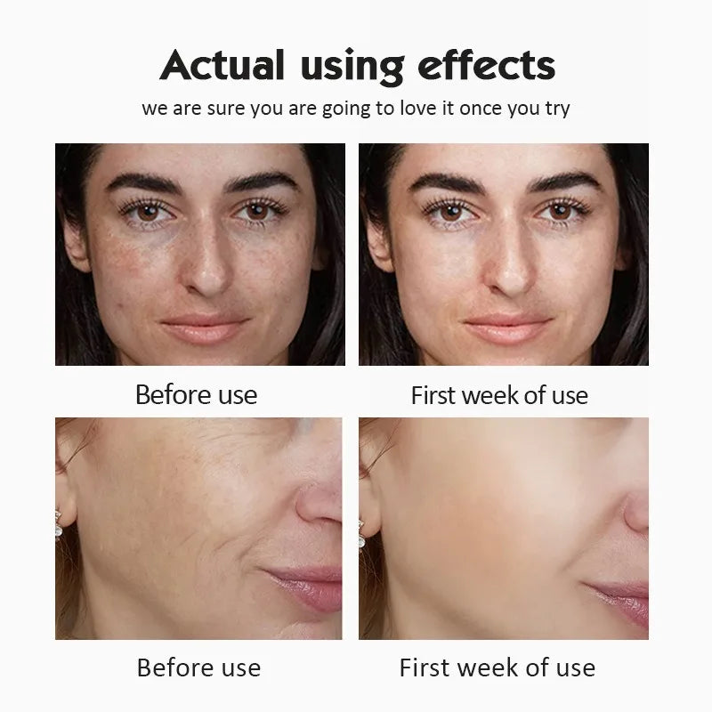 Feature Twenty Percent Vitamin C Ampoule Serum Set