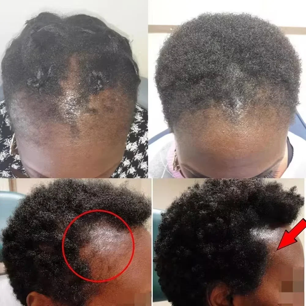 Batana Oil Hair Growth Set for Damaged Scalp Treatment