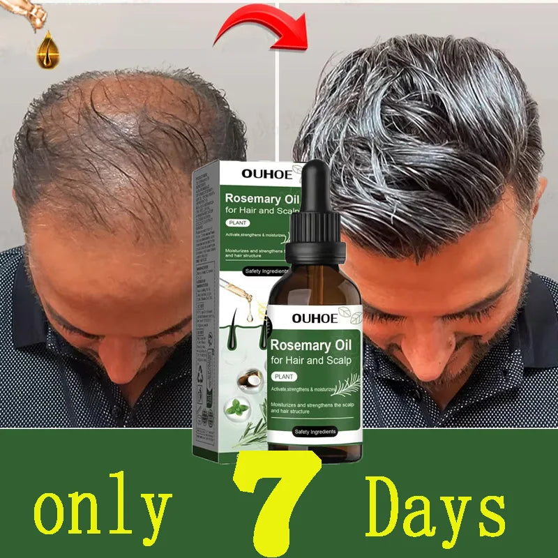Ouhoe Hair Growth Oil For Anti Hair Loss Treatment