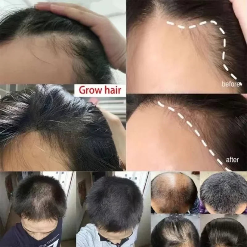 Batana Oil Hair Growth Set for Damaged Scalp Treatment