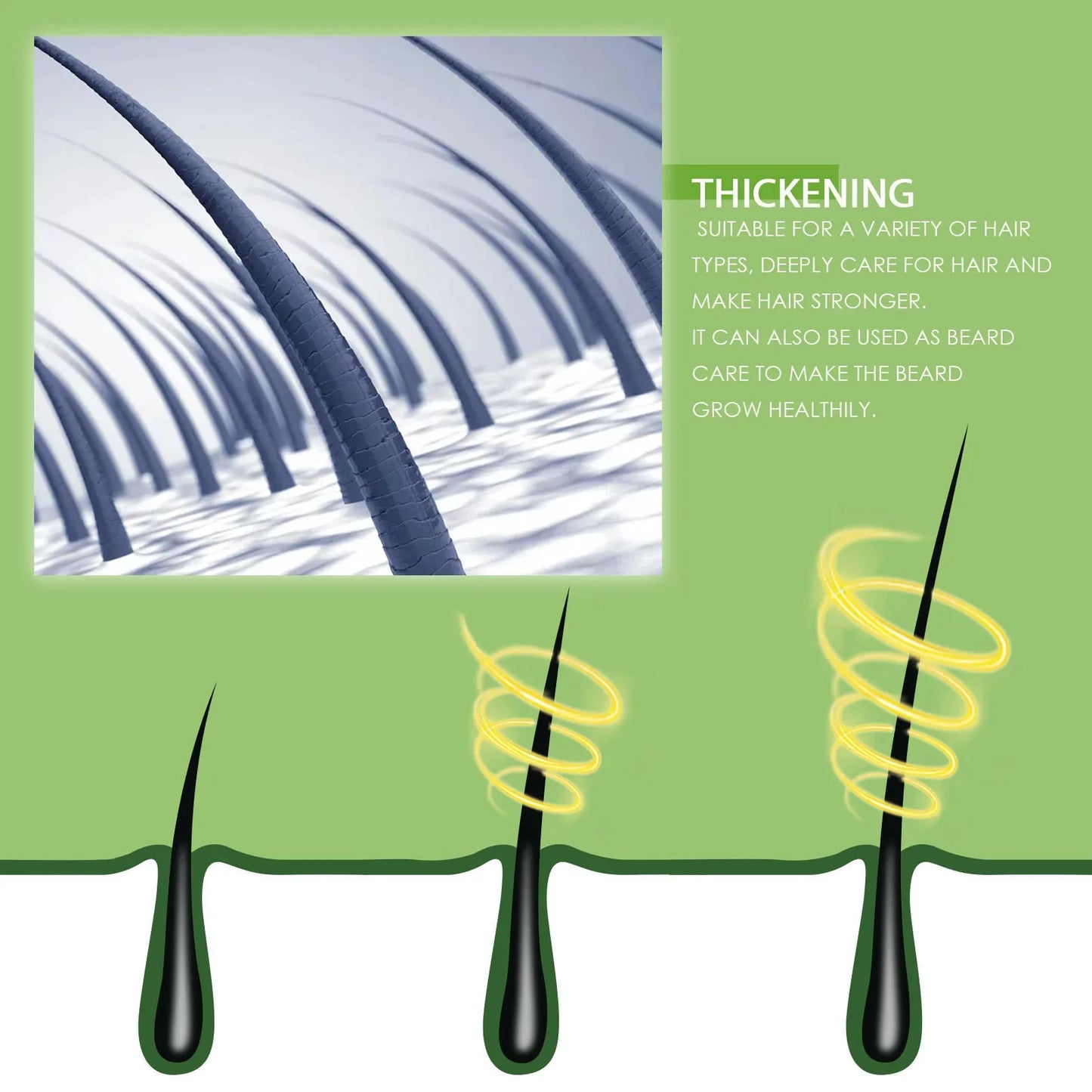 Ouhoe Hair Growth Oil For Anti Hair Loss Treatment