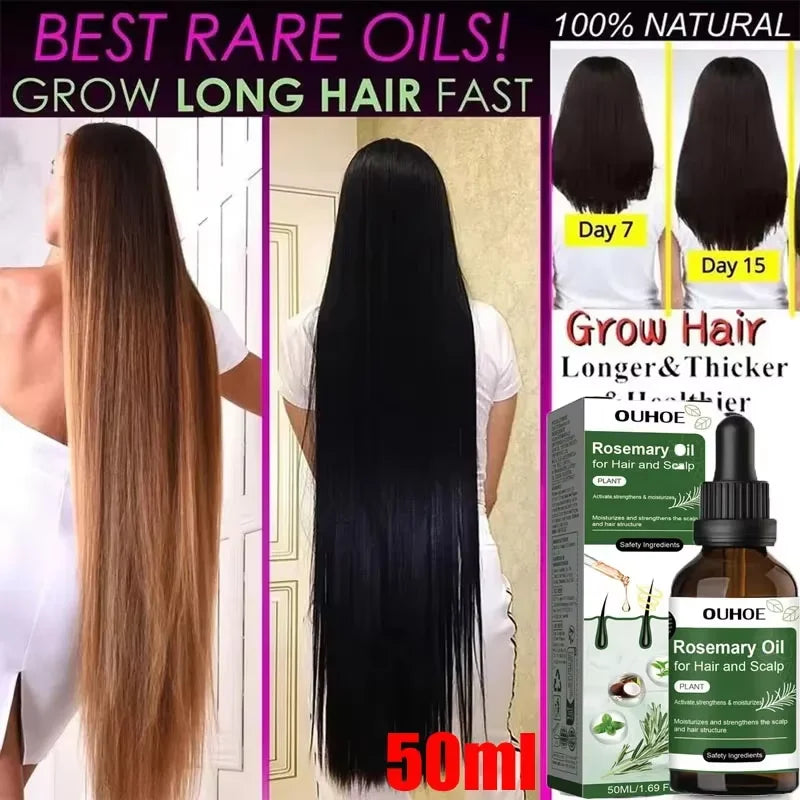 Ouhoe Hair Growth Oil For Anti Hair Loss Treatment