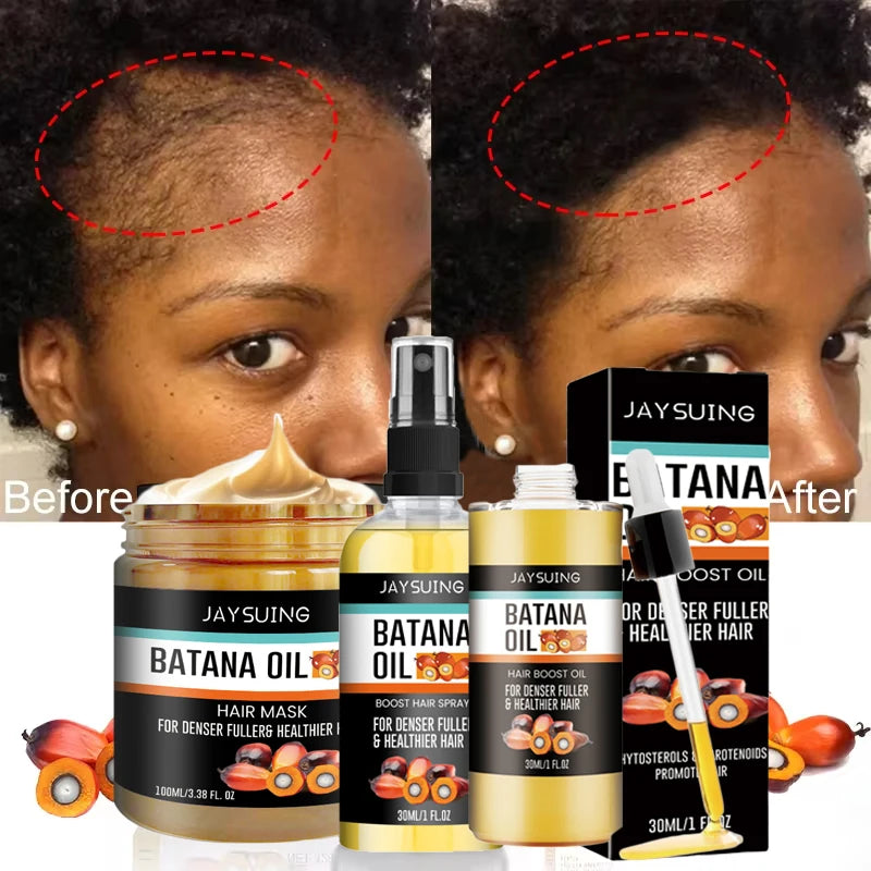 Batana Oil Hair Growth Set for Damaged Scalp Treatment